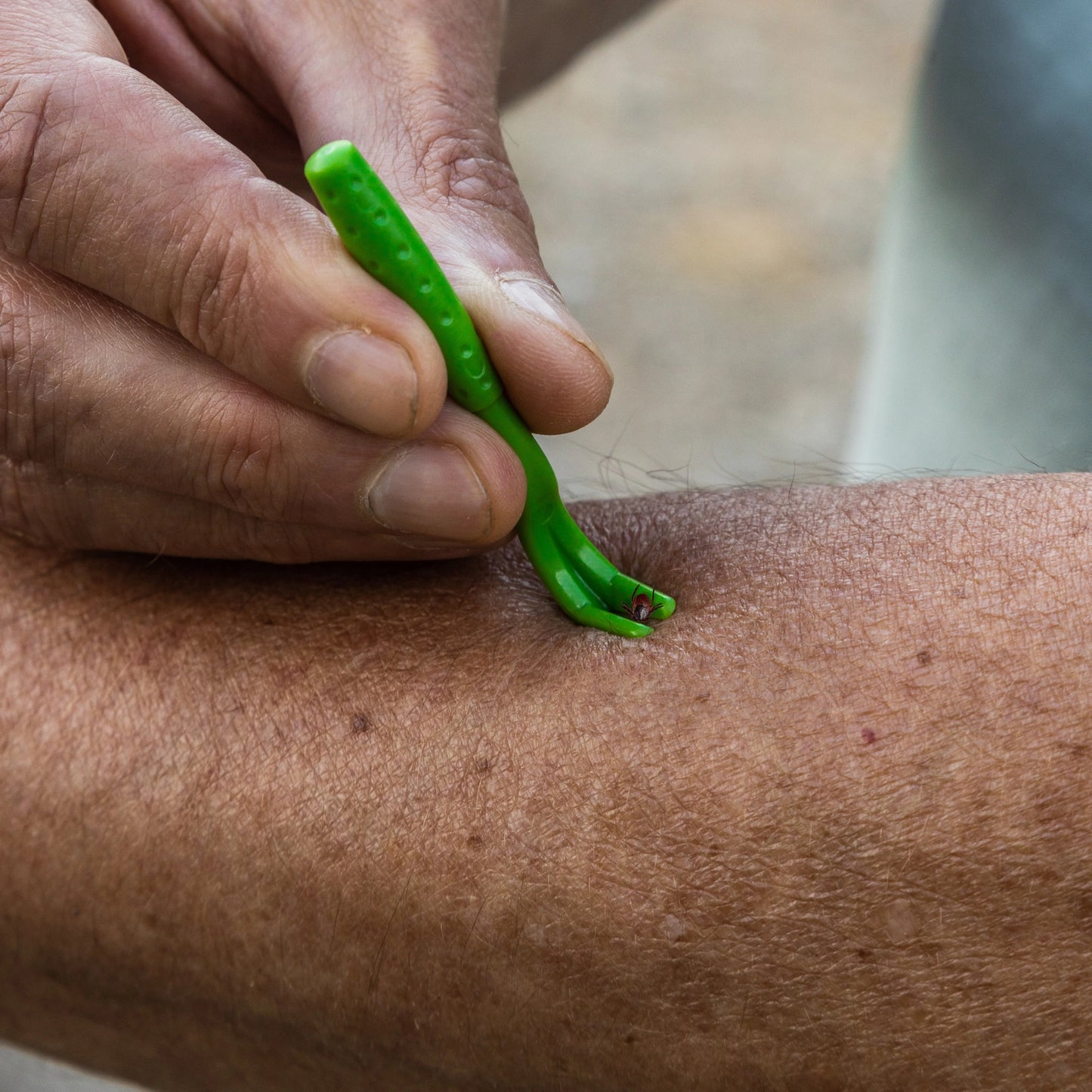 Tick Remover Value 3 Pack